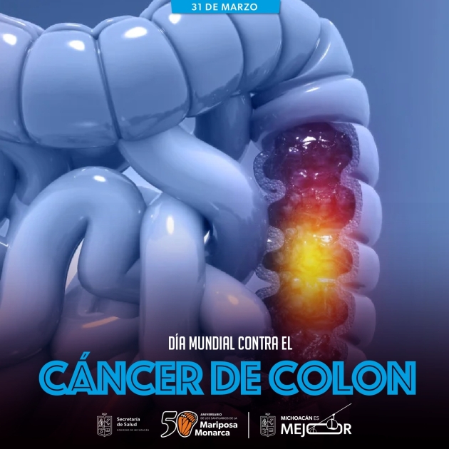 Cáncer de Colon, detectarlo a tiempo es clave para salvar vidas: SSM 