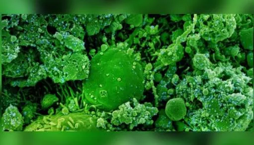Francia identifica nueva variante de Covid-19 denominada IHU 