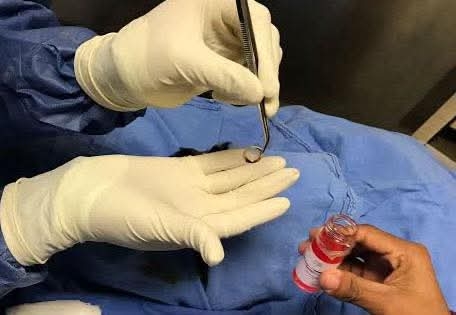 Obtiene HGZ No. 83 del IMSS Michoacán licencia para procuración de órganos y tejidos 